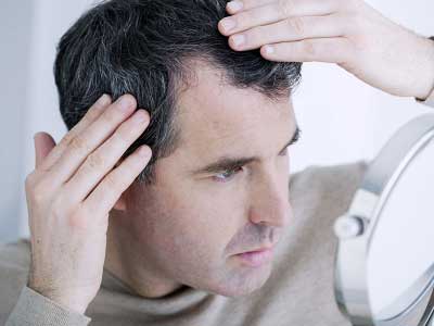 نقش ژنتیک در ریزش مو